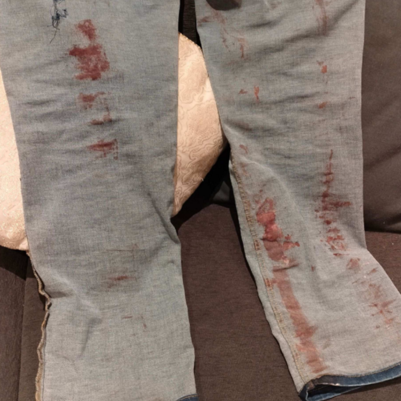 Hundägare åtalas efter attack på strand episode artwork