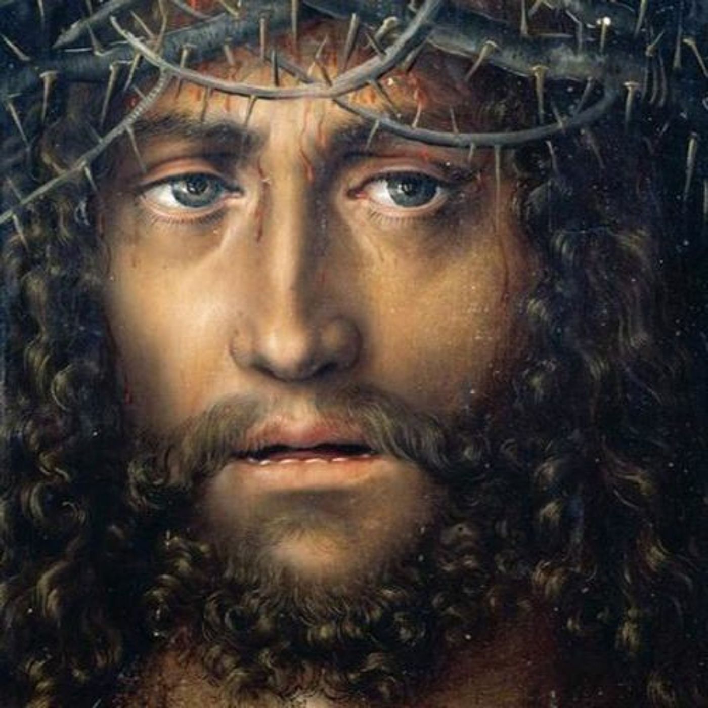 Jesus came and did two healings on listener episode artwork