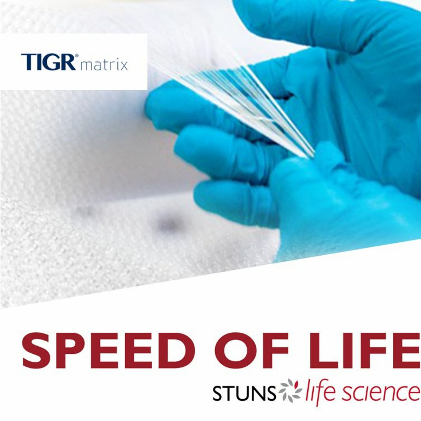 Novus Scientific AB - Improving patient care with TIGR® Matrix episode artwork