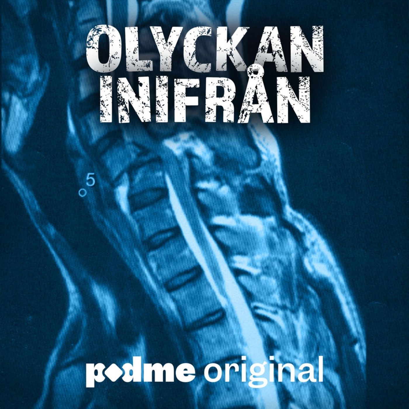 Jonas bröt nacken på svensexan Jonas bröt nacken på svensexan