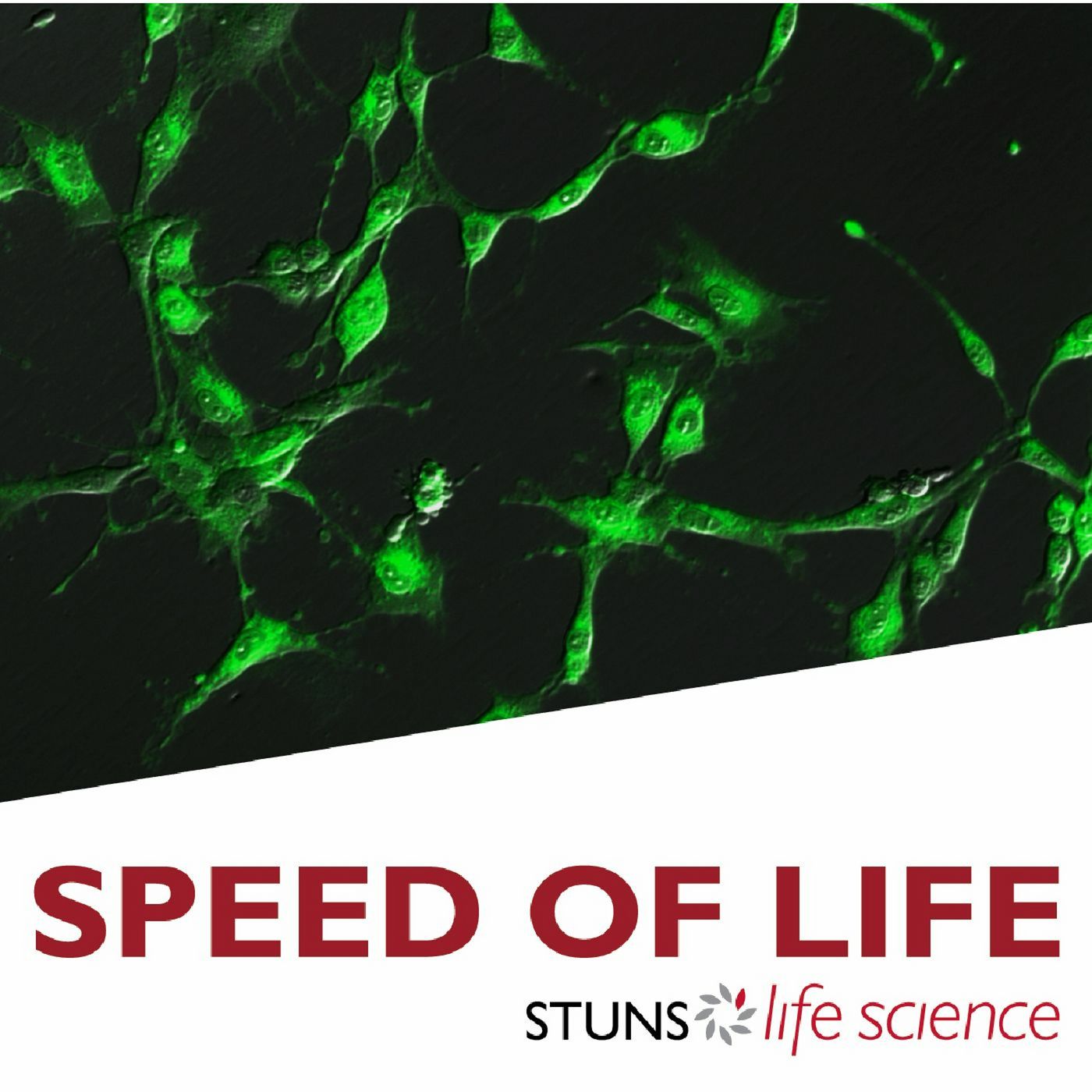 Celluminova AB - Near-instant detection of live stem cells episode artwork